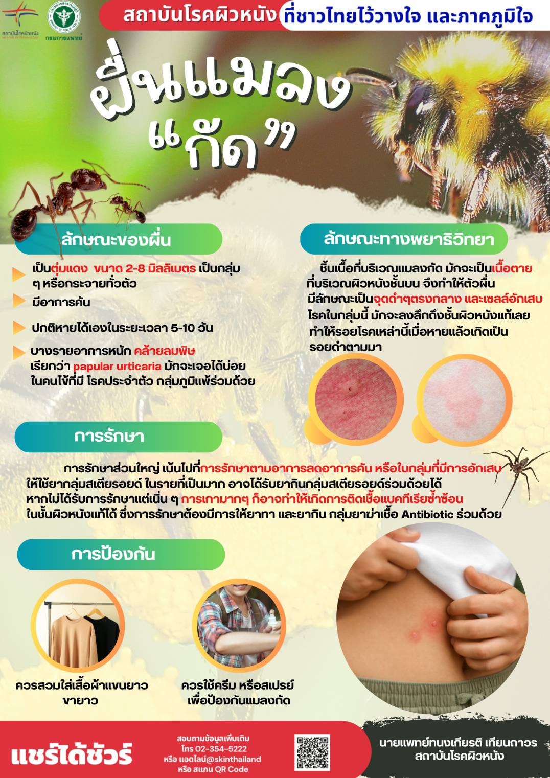 ผื่นแมลงกัด (Insect bite reaction)