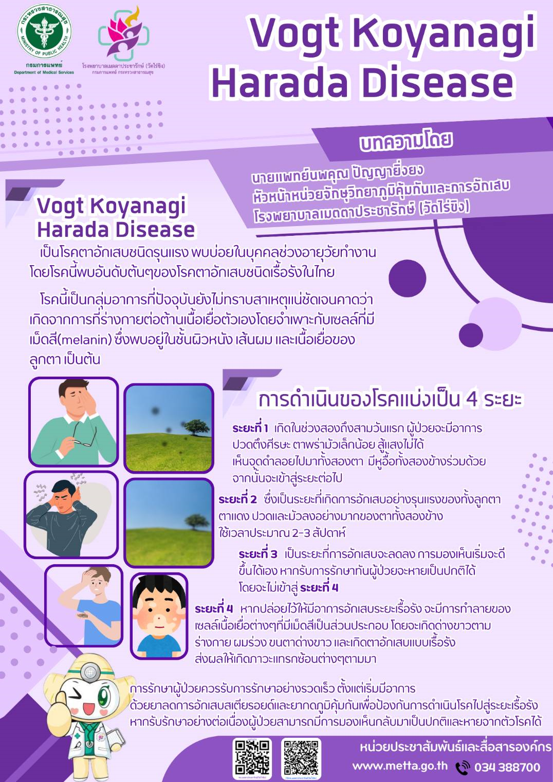  โรคตา Vogt-Koyanagi-Harada Disease (VKH) อันตรายไหม !