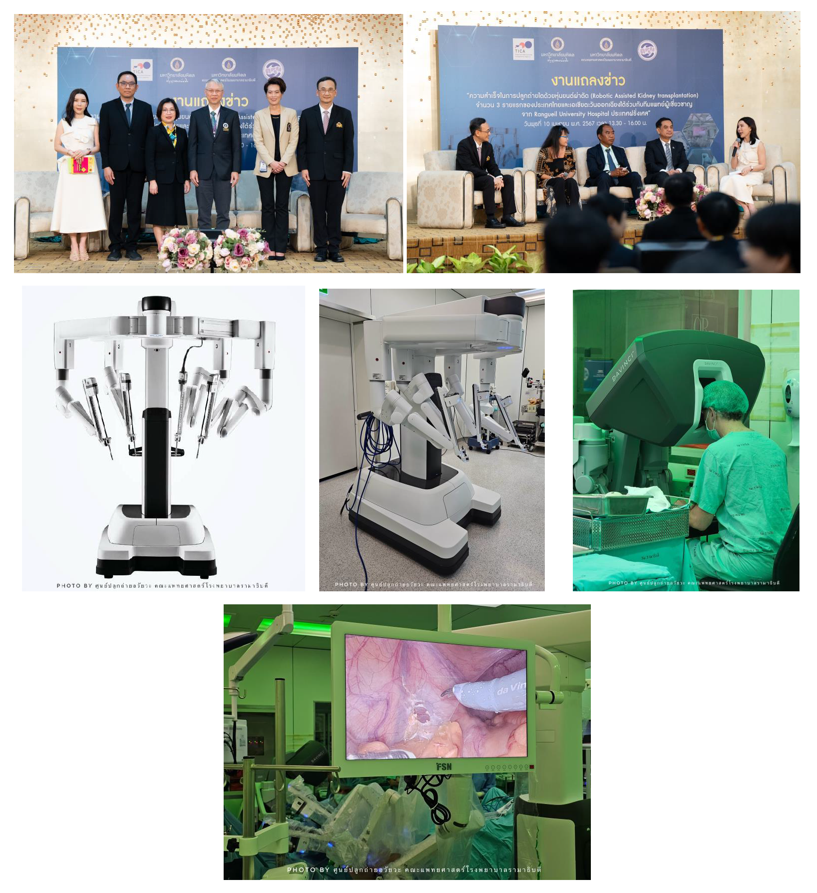 ความสำเร็จในการปลูกถ่ายไตด้วยหุ่นยนต์ผ่าตัด  (Robotic Assisted Kidney transplantation) 3 ราย  