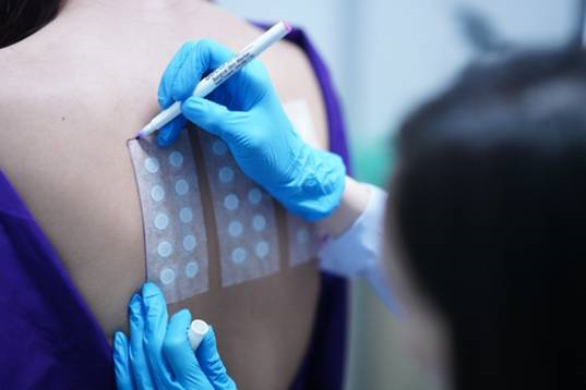 การทดสอบผื่นแพ้สัมผัส (Patch Test)