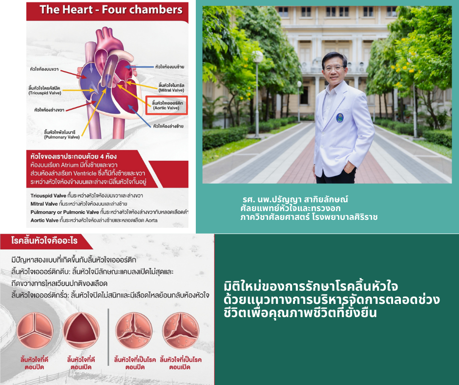 มิติใหม่ของการรักษาโรคลิ้นหัวใจ ด้วยแนวทางการบริหารจัดการตลอดช่วงชีวิตเพื่อคุณภาพชีวิตที่ยั่งยืน
