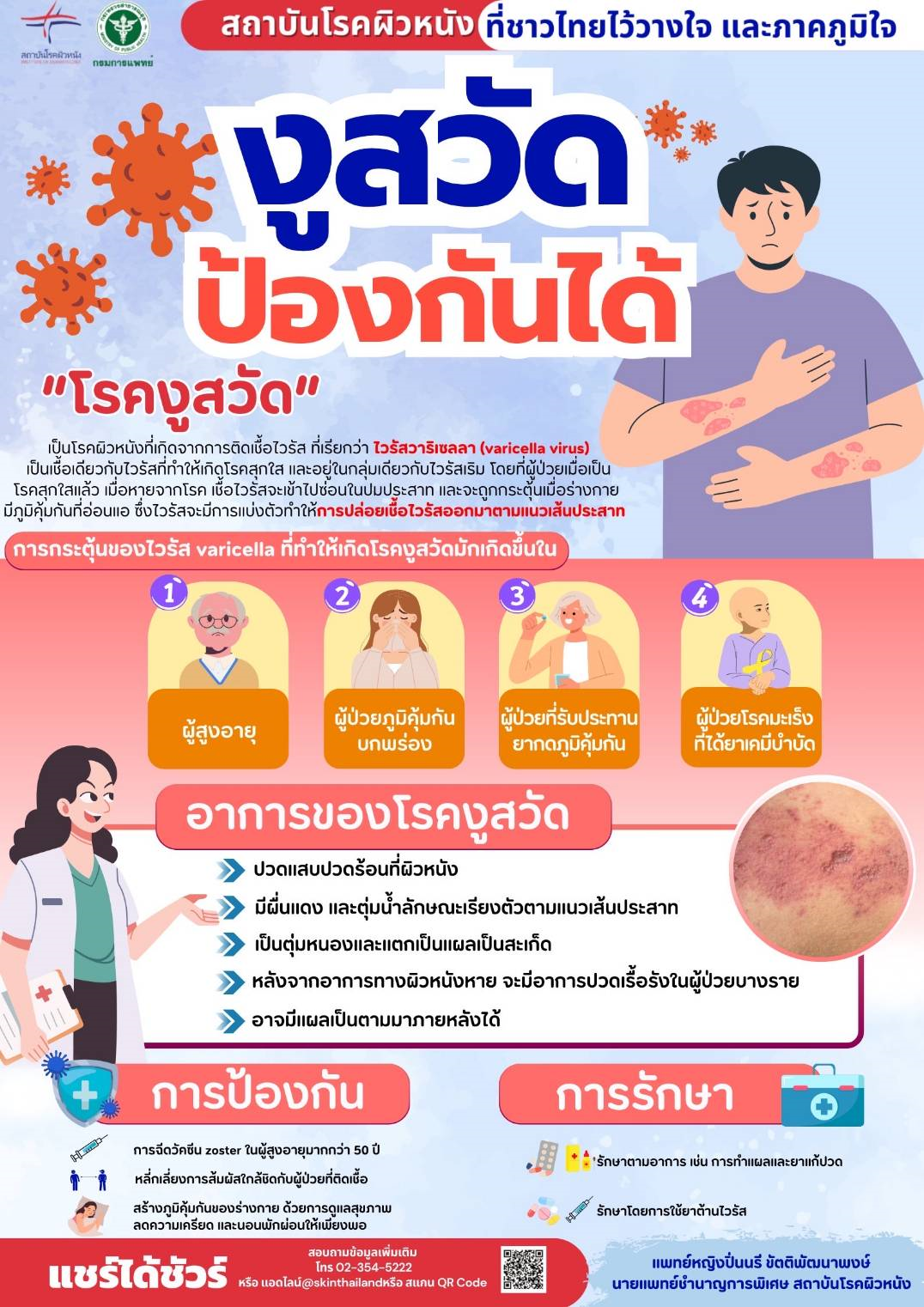 โรคงูสวัด ป้องกันได้