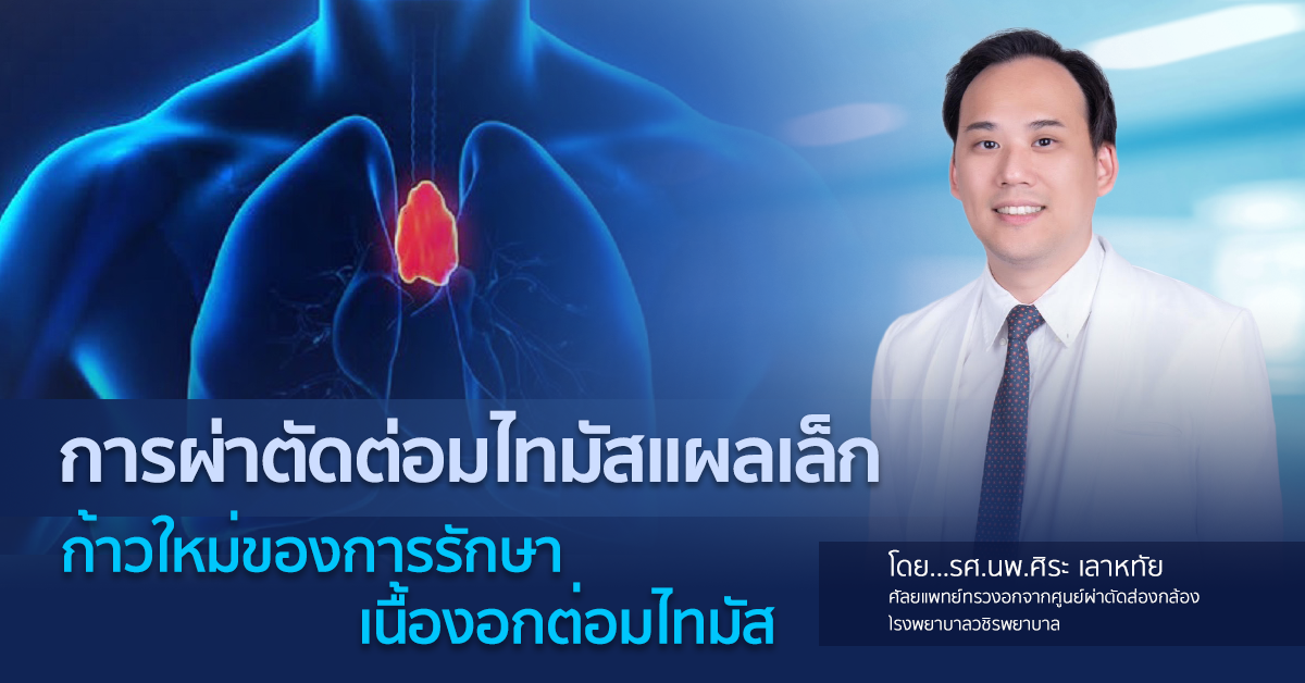 การผ่าตัดต่อมไทมัสแผลเล็ก : ก้าวใหม่ของการรักษาเนื้องอกต่อมไทมัส โดย รศ.นพ.ศิระ เลาหทัย  ศัลยแพทย์ทรวงอกจากศูนย์ผ่าตัดส่องกล้อง โรงพยาบาลวชิรพยาบาล