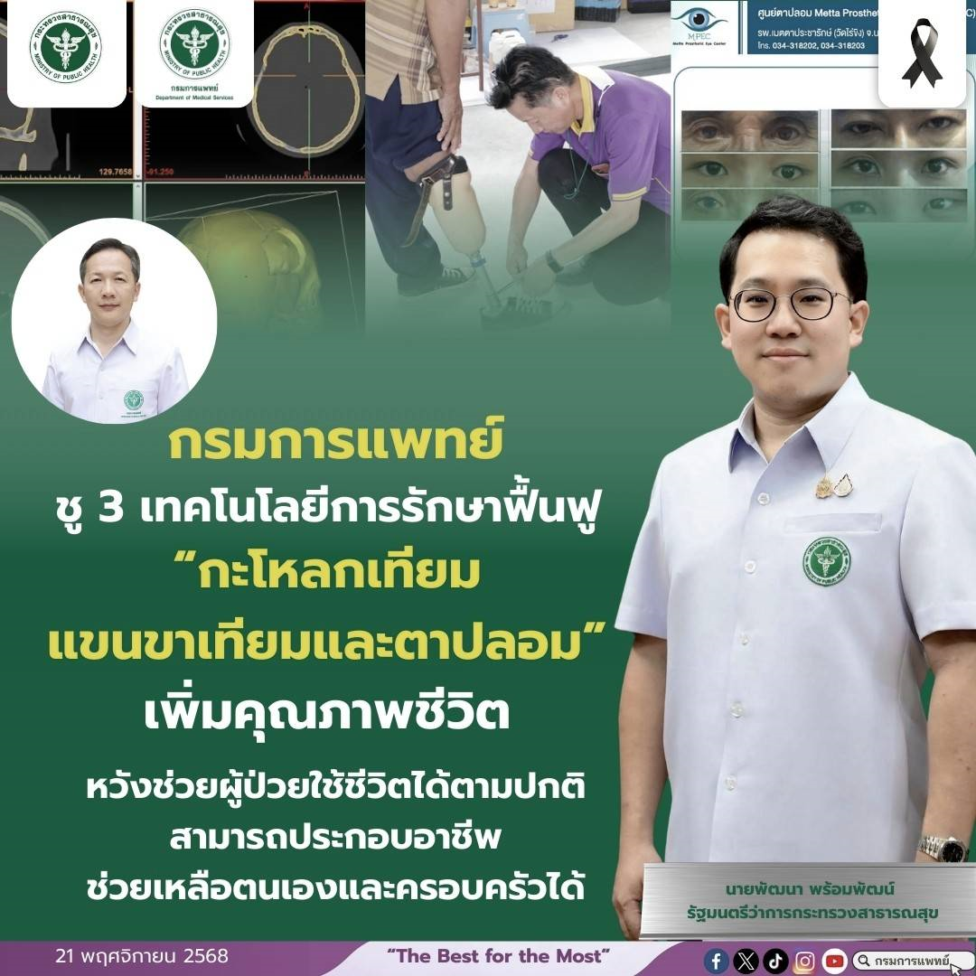 กรมการแพทย์ชู 3 เทคโนโลยีการรักษาฟื้นฟู “กะโหลกเทียม แขนขาเทียมและตาปลอม” เพิ่มคุณภาพชีวิต หวังช่วยผู้ป่วยใช้ชีวิตได้ตามปกติ สามารถประกอบอาชีพช่วยเหลือตนเองและครอบครัวได้
