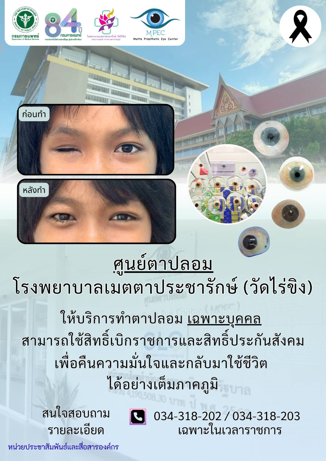 ข่าวดีผู้ประกันตน! รพ.เมตตาประชารักษ์ (วัดไร่ขิง) พร้อมให้บริการทำ “ลูกตาเทียมเฉพาะบุคคล” ตามสิทธิ์ประกันสังคม หนุนฟื้นฟูคุณภาพชีวิตและสร้างโอกาสในการทำงาน